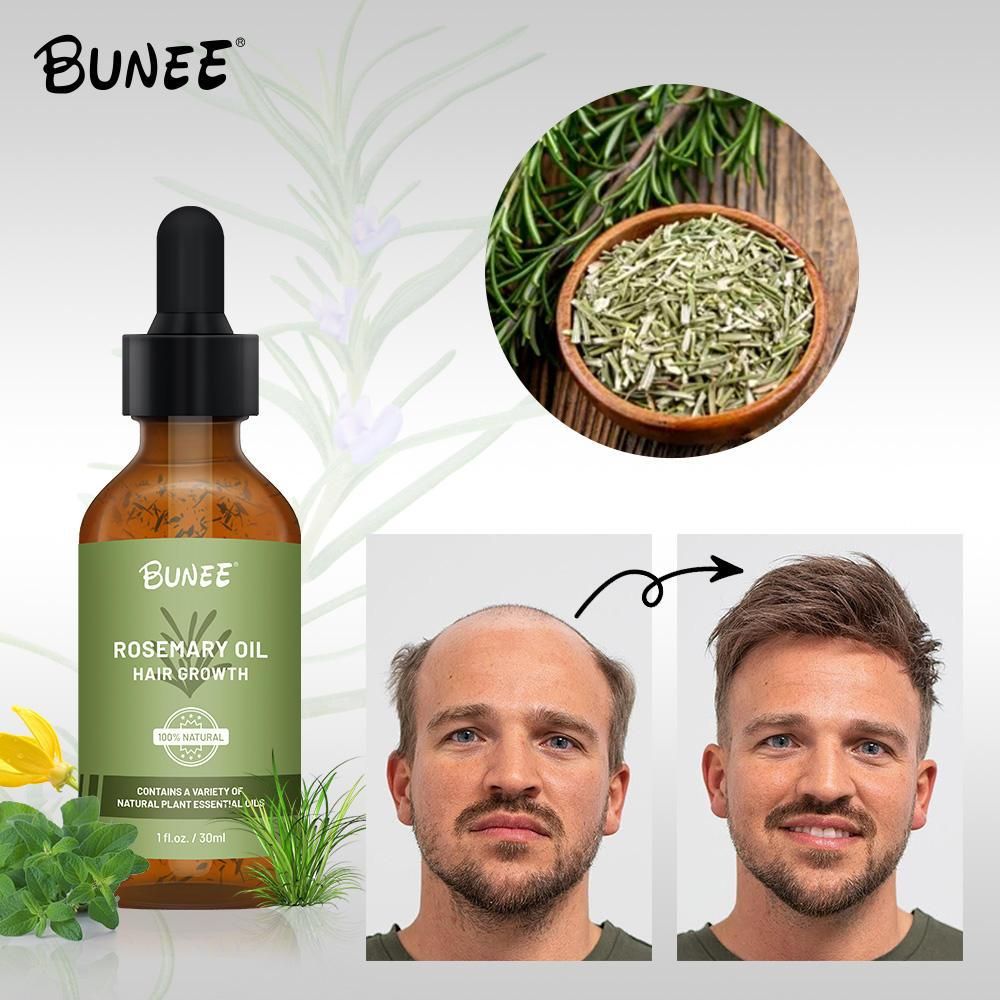 BUNEE™ Rosemary Hair Growth Serum Oil
