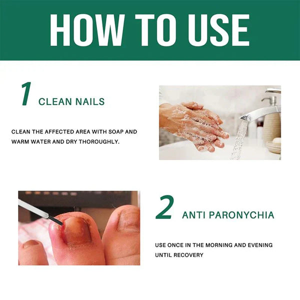 All-In-One Nail Repair & Anti-Paronychia Relief Oil (Buy 1 Get 1 Free)