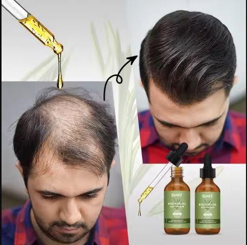 BUNEE™  Rosemary Hair Growth Serum Oil