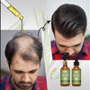 BUNEE™  Rosemary Hair Growth Serum Oil