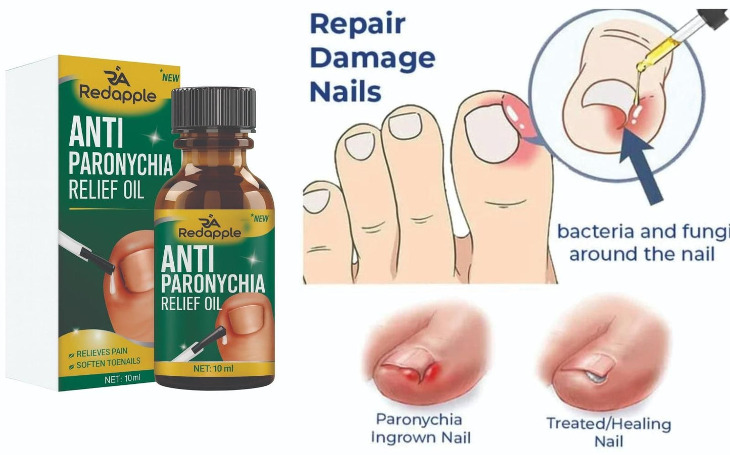 All-In-One Nail Repair & Anti-Paronychia Relief Oil (Buy 1 Get 1 Free)