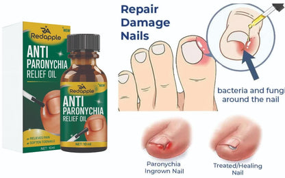 All-In-One Nail Repair & Anti-Paronychia Relief Oil (Buy 1 Get 1 Free)