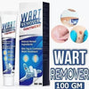 Wart Remover Ointment for All Skin Types (Pack of 1)