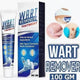 Wart Remover Ointment for All Skin Types (Pack of 1)