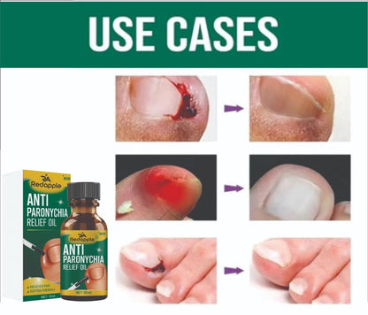 All-In-One Nail Repair & Anti-Paronychia Relief Oil (Buy 1 Get 1 Free)