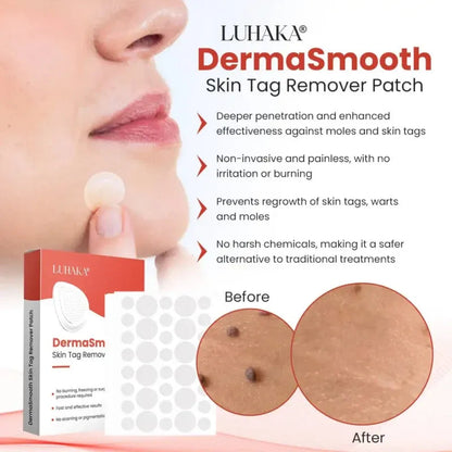 Derma Smooth Skin Tag Removal Patch | Secret to Spotless Skin ✨ (Pack Of 36)